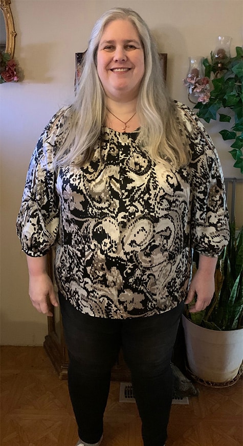 Before Image: Physician-led Weight Loss - front