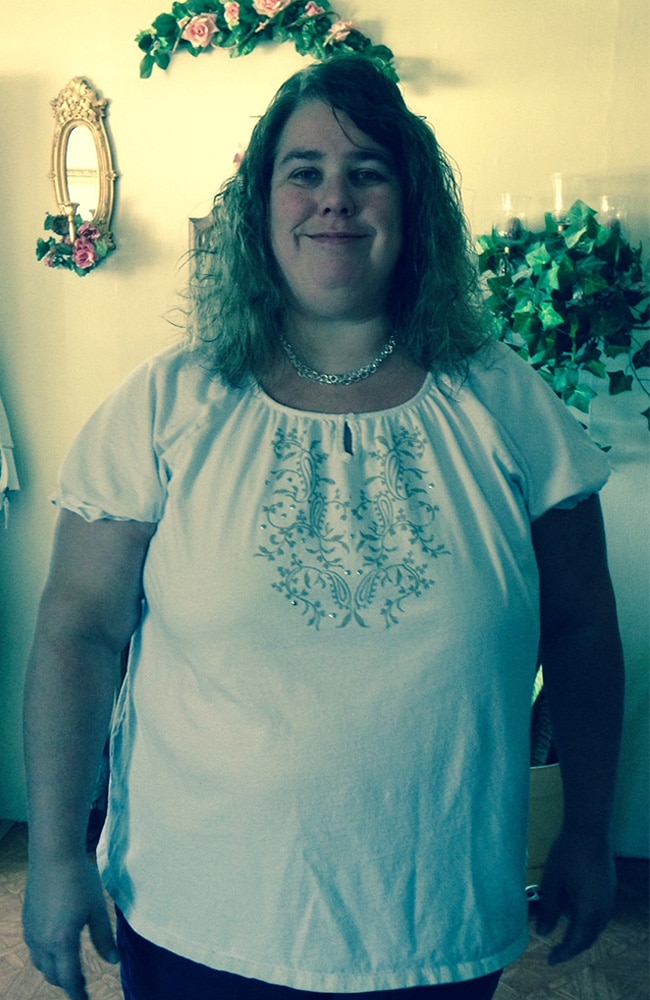 Before Image: Physician-led Weight Loss - front
