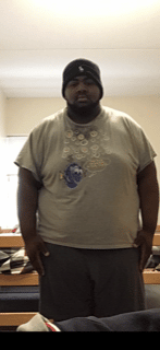 Before Image: Physician-led Weight Loss - front