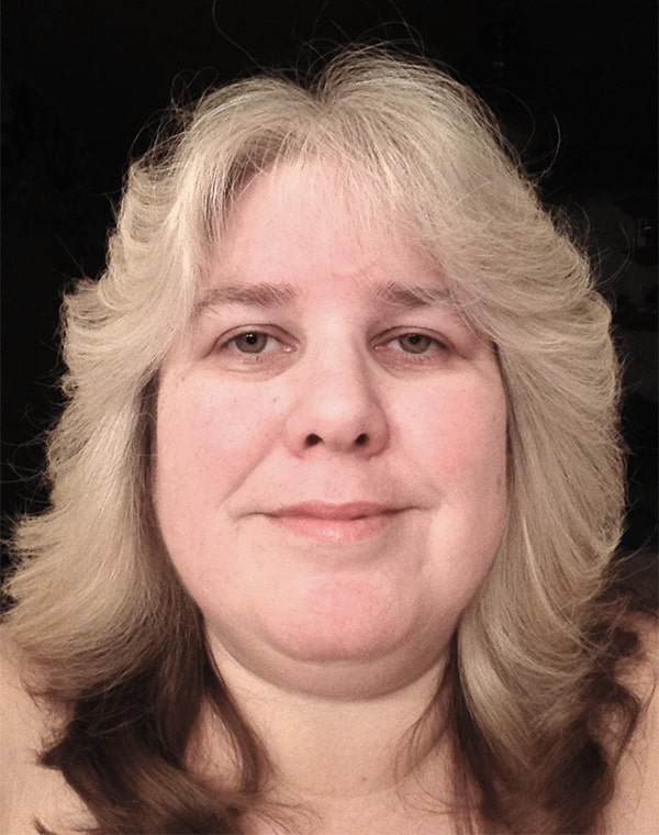 Before Image: Physician-led Weight Loss - front