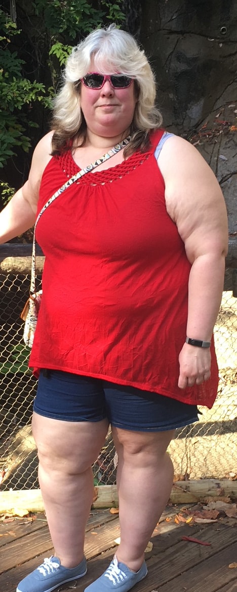 Before Image: Physician-led Weight Loss - left-front-oblique