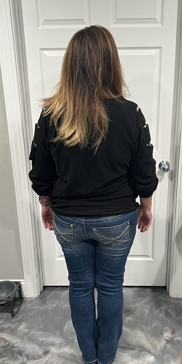 After Image: Physician-led Weight Loss - front