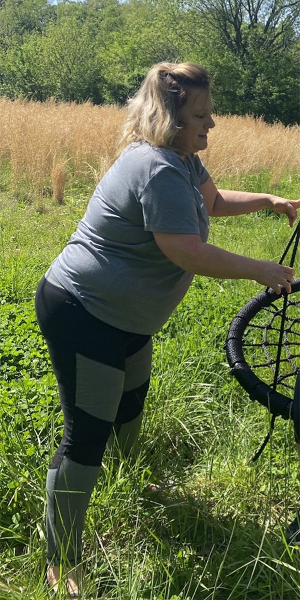 Before Image: Physician-led Weight Loss - front