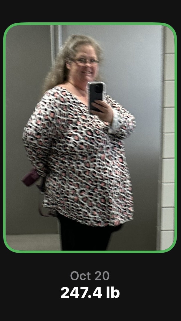 After Image: Physician-led Weight Loss - front