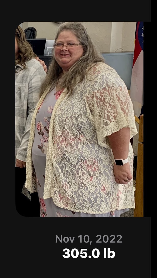 Before Image: Physician-led Weight Loss - front
