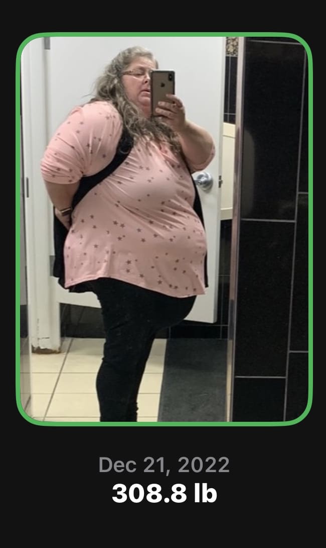 Before Image: Physician-led Weight Loss - right-front-oblique